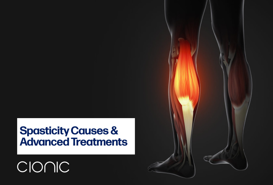 Spasticity: Causes, Symptoms, and Advanced Treatments